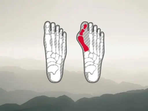 Fußskelett mit rot markiertem Ballenbereich, ideal für die Auswahl von hallux wanderschuhen.