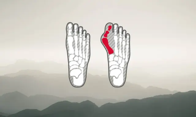 Fußskelett mit rot markiertem Ballenbereich, ideal für die Auswahl von hallux wanderschuhen.