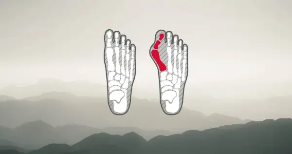 Fußskelett mit rot markiertem Ballenbereich, ideal für die Auswahl von hallux wanderschuhen.